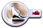 Total Knee Replacement